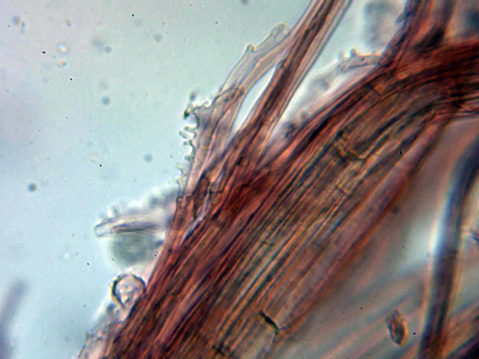 Microscopía de Mycena juniperina - 10 - Hifas diverticuladas estípite